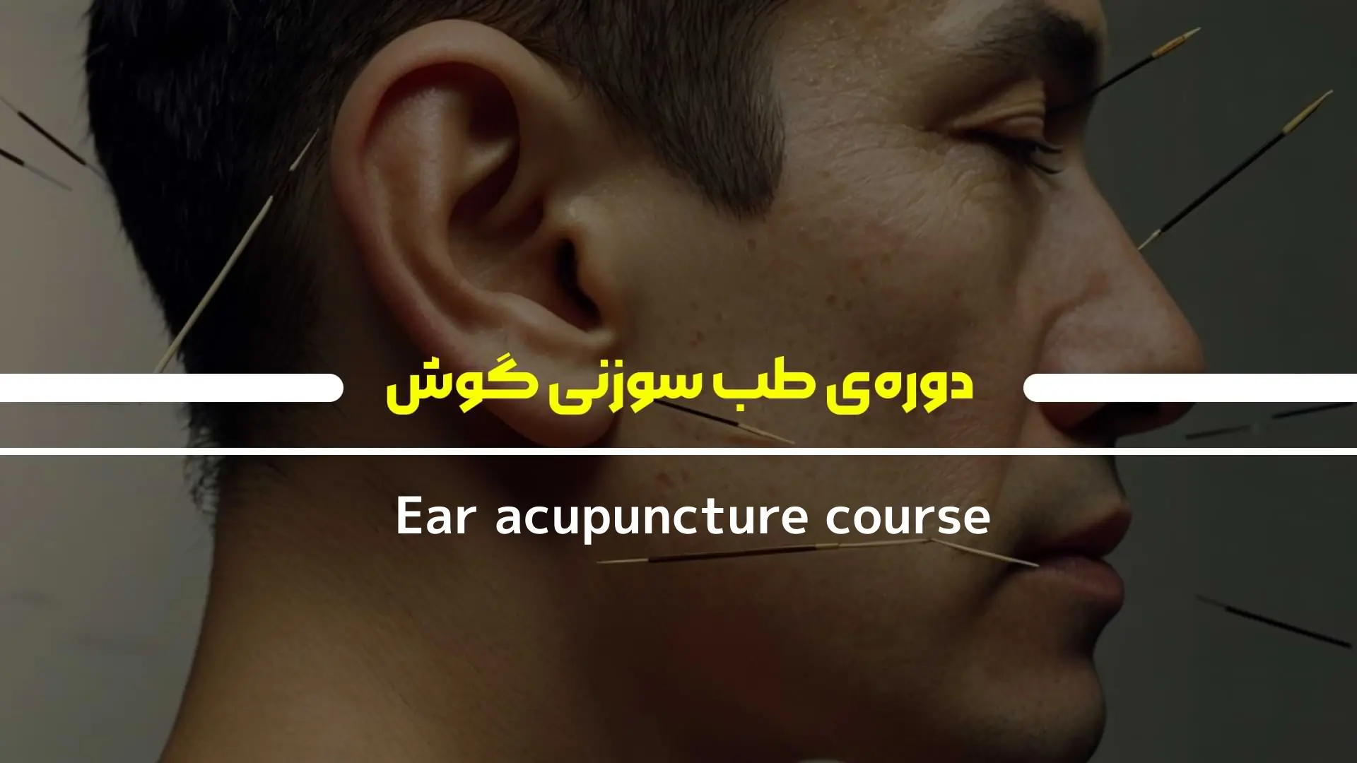دوره‌ی طب سوزنی گوش