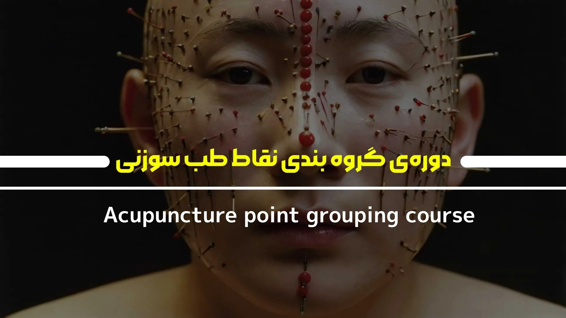 دوره‌ی گروه بندی نقاط طب سوزنی