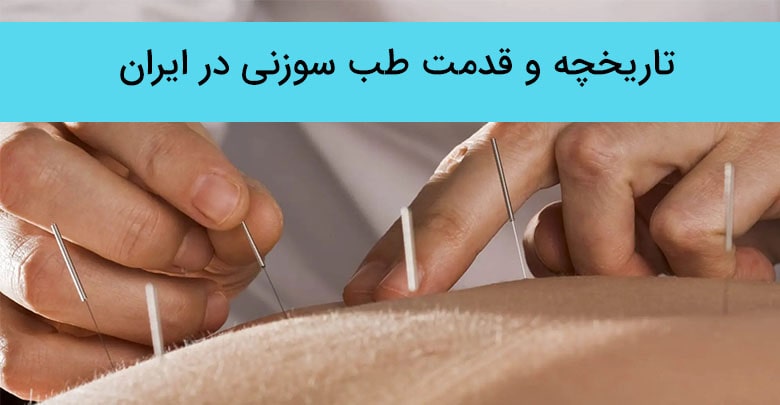 تاریخچه طب سوزنی